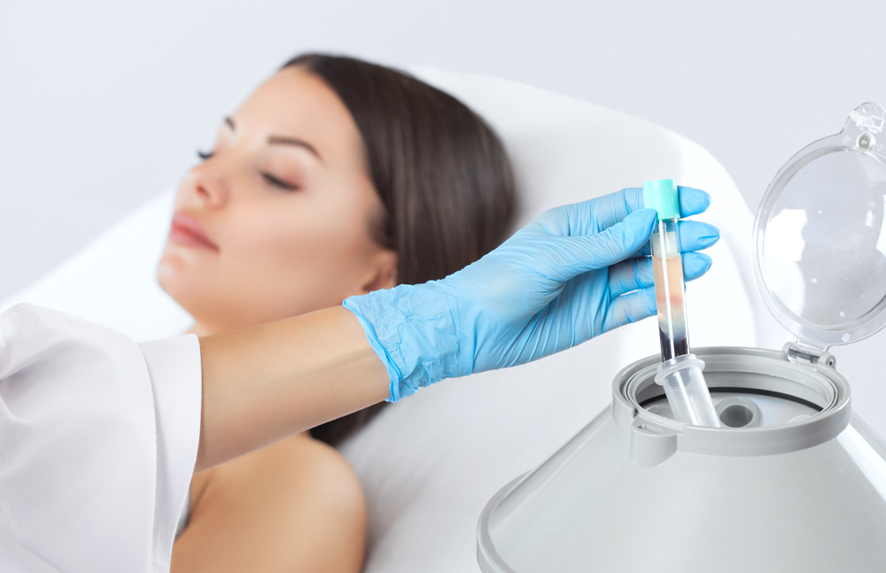 PRP Therapy