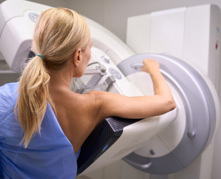 3D Mammography