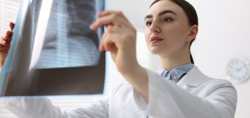 24-Hour X-Ray Access Near Hagerstown, MD: Everything You Need to Know for Quick Care