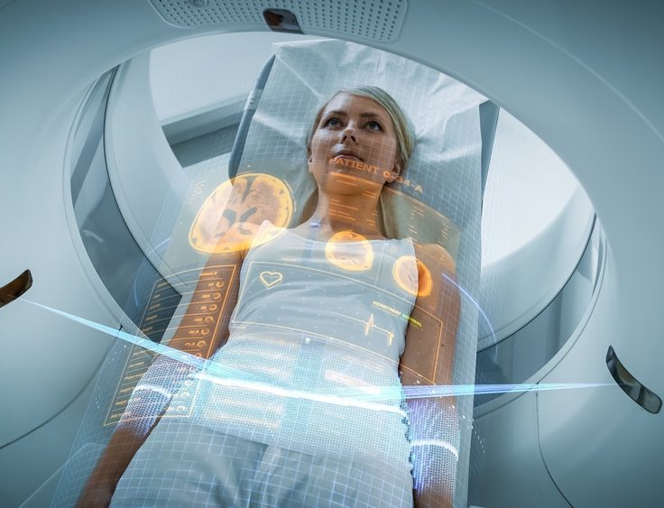 Amyloid PET Brain Scan
