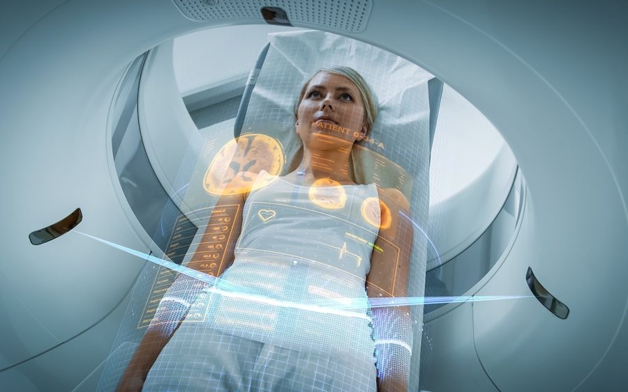 Amyloid PET Brain Scan