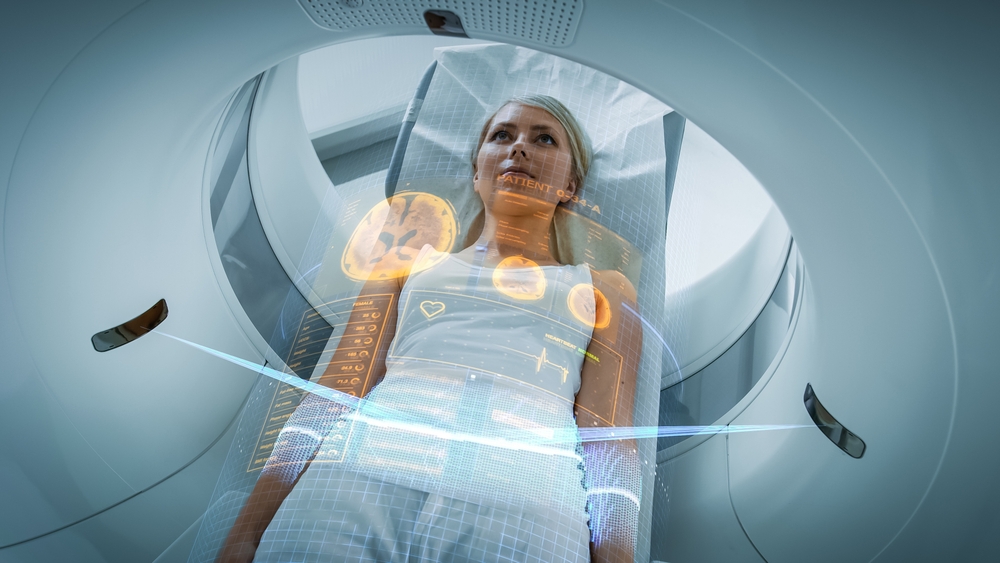 Amyloid PET Brain Scan