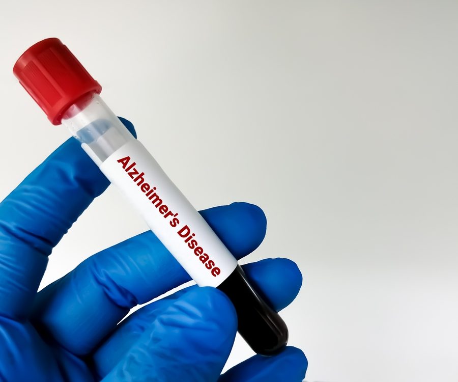 Alzheimer’s Testing Cumberland Maryland