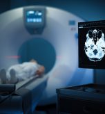 Maryland Amyloid PET Brain Scan for Alzheimer’s Diagnosis: What You Need to Know