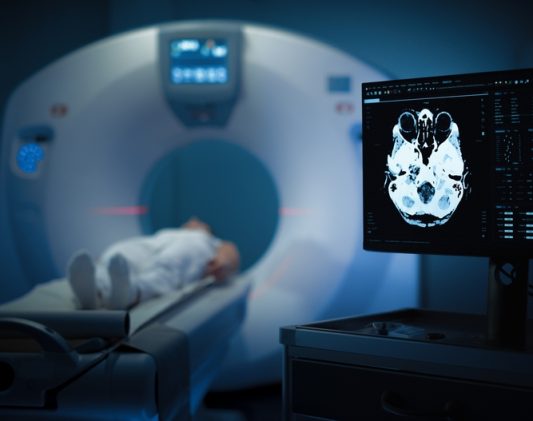 Maryland Amyloid PET Brain Scan for Alzheimer’s Diagnosis: What You Need to Know
