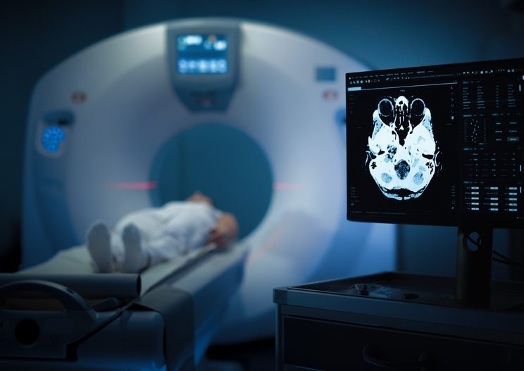 Maryland Amyloid PET Brain Scan for Alzheimer’s Diagnosis: What You Need to Know