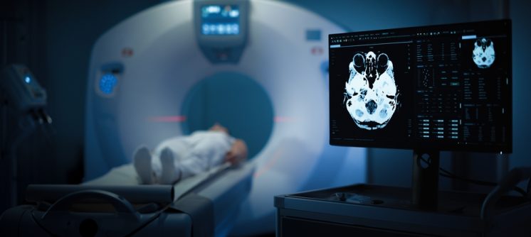 Maryland Amyloid PET Brain Scan for Alzheimer’s Diagnosis: What You Need to Know
