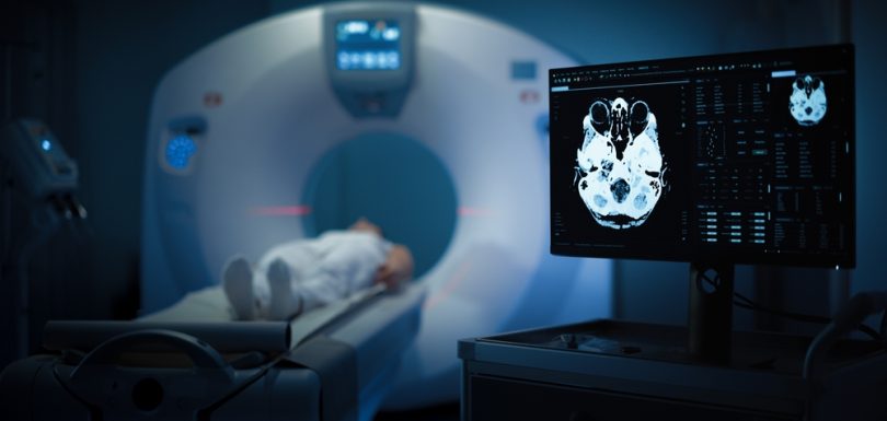 Maryland Amyloid PET Brain Scan for Alzheimer’s Diagnosis: What You Need to Know