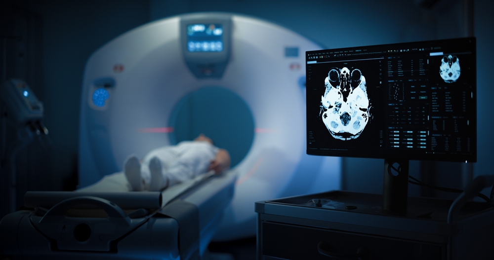 Maryland Amyloid PET Brain Scan for Alzheimer’s Diagnosis: What You Need to Know