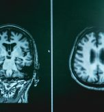 How Alzheimer’s Diagnostic Testing and Early Detection in Hagerstown, Maryland Strengthens Families