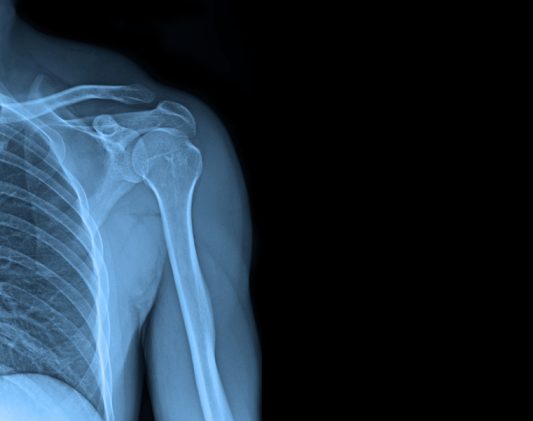 Book a Same-Day X-Ray Appointment Near Martinsburg, West Virginia: How to Prepare and What to Expect When You Arrive