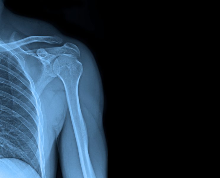 Book a Same-Day X-Ray Appointment Near Martinsburg, West Virginia: How to Prepare and What to Expect When You Arrive