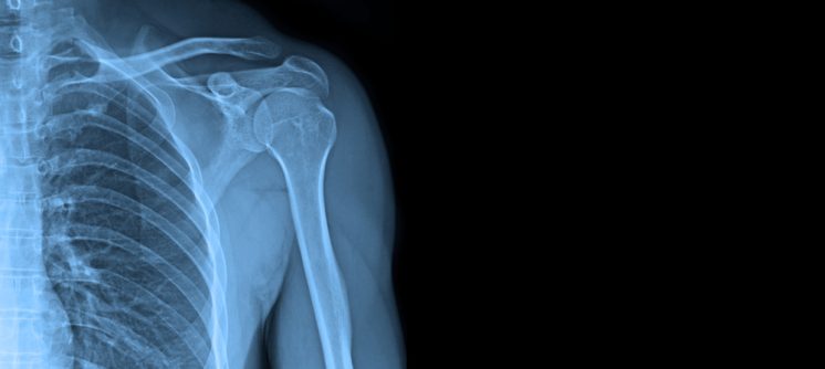 Book a Same-Day X-Ray Appointment Near Martinsburg, West Virginia: How to Prepare and What to Expect When You Arrive