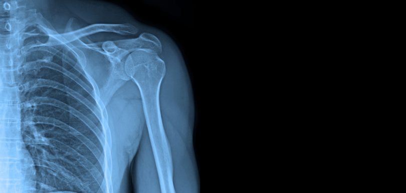 Book a Same-Day X-Ray Appointment Near Martinsburg, West Virginia: How to Prepare and What to Expect When You Arrive