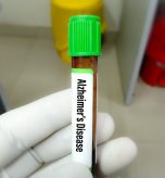 Here’s Where to Get an Amyloid PET Scan Near Me in Maryland