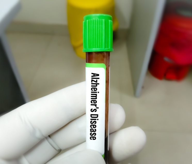 Here’s Where to Get an Amyloid PET Scan Near Me in Maryland