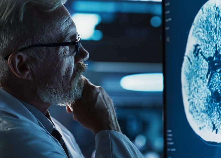 Alzheimer’s Treatments Cumberland MD