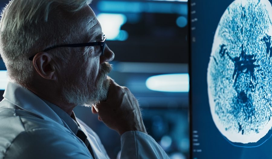 Alzheimer’s Treatments Cumberland MD