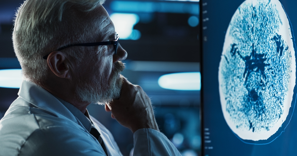 Alzheimer’s Treatments Cumberland MD