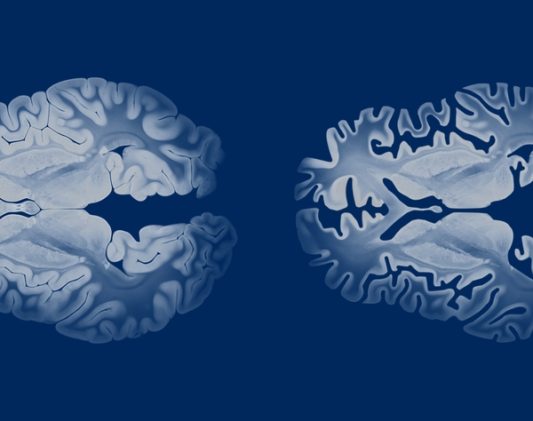 6 Tips to Guide Your Search for the Best Alzheimer’s Testing and Evaluation Center in Western Maryland