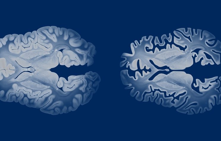 6 Tips to Guide Your Search for the Best Alzheimer’s Testing and Evaluation Center in Western Maryland