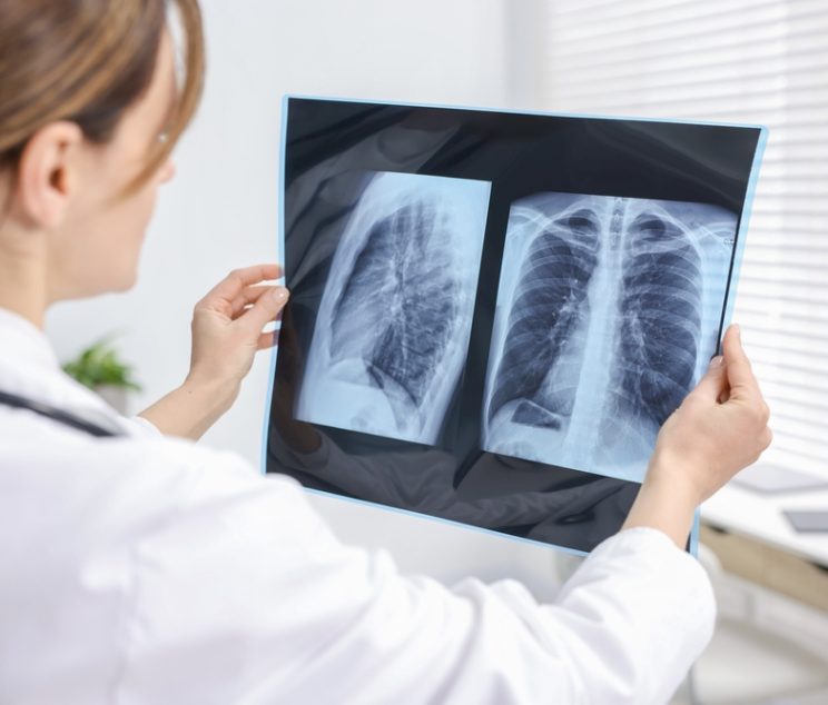 Why You Can’t Afford to Ignore Screening Imaging in Cumberland