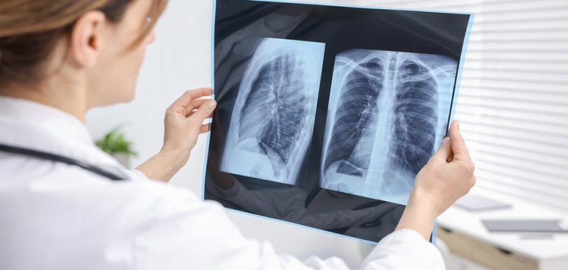 Why You Can’t Afford to Ignore Screening Imaging in Cumberland