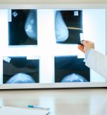 Screening Mammogram Appointments in Cumberland, MD: Prioritizing Early Detection for Women’s Health