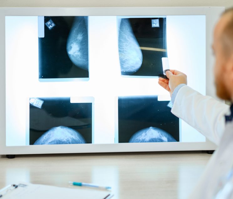 Screening Mammogram Appointments in Cumberland, MD: Prioritizing Early Detection for Women’s Health