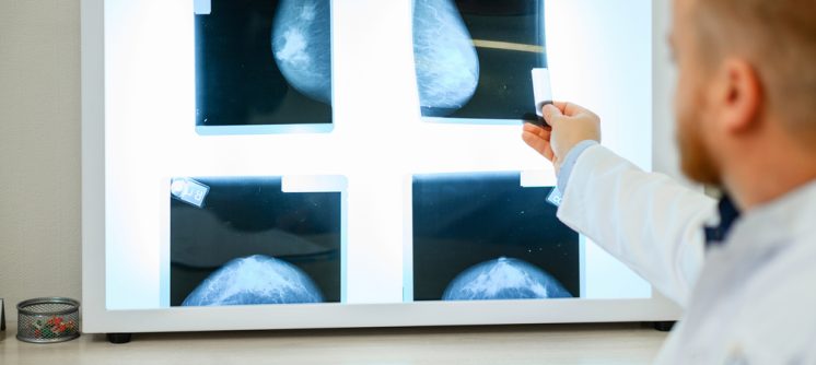 Screening Mammogram Appointments in Cumberland, MD: Prioritizing Early Detection for Women’s Health