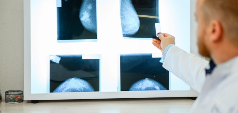 Screening Mammogram Appointments in Cumberland, MD: Prioritizing Early Detection for Women’s Health