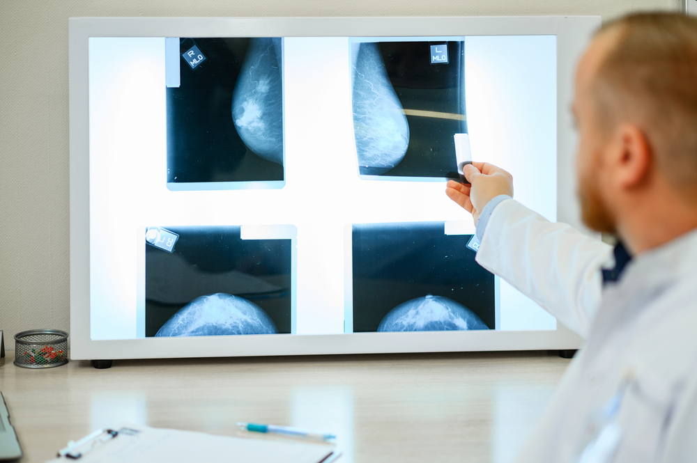 Screening Mammogram Appointments in Cumberland, MD: Prioritizing Early Detection for Women’s Health