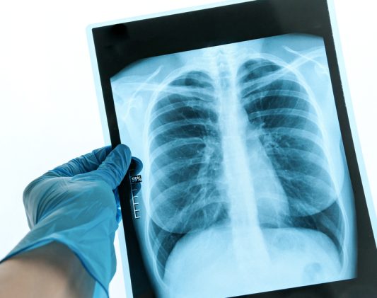 Radiology Imaging Center for MRI and CT Scans in Winchester VA