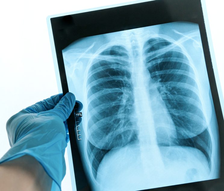 Radiology Imaging Center for MRI and CT Scans in Winchester VA