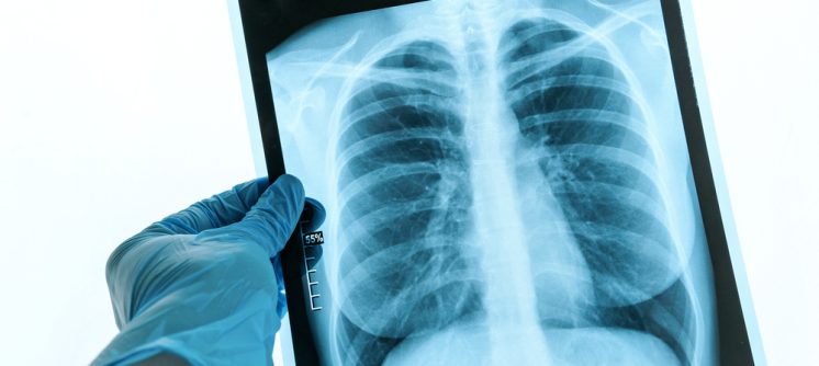 Radiology Imaging Center for MRI and CT Scans in Winchester VA