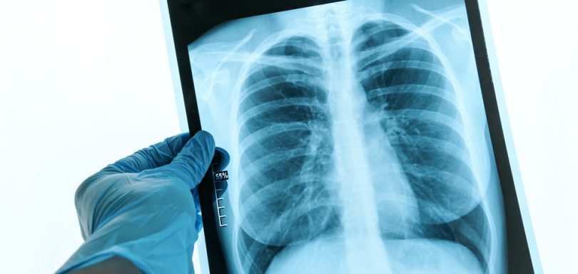 Radiology Imaging Center for MRI and CT Scans in Winchester VA