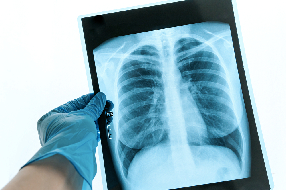 Radiology Imaging Center for MRI and CT Scans in Winchester VA