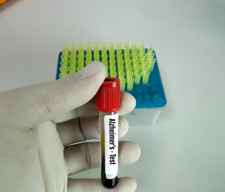 Schedule an Amyloid PET Scan for Alzheimer’s Near Cumberland, MD: Early Detection Matters