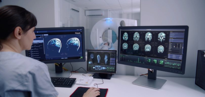 Same-Week MRI Imaging Slots Near LaVale, MD for Faster Answers