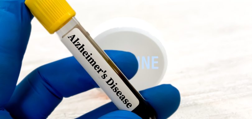 Alzheimer’s Amyloid PET Scan Imaging Services in Hagerstown MD