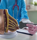 Diagnostic Mammogram Appointments for Breast Concerns Near Hagerstown, MD