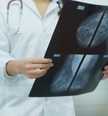 Radiology Appointments for Mammograms and MRIs Near Cumberland, MD: Prioritize Your Health Today