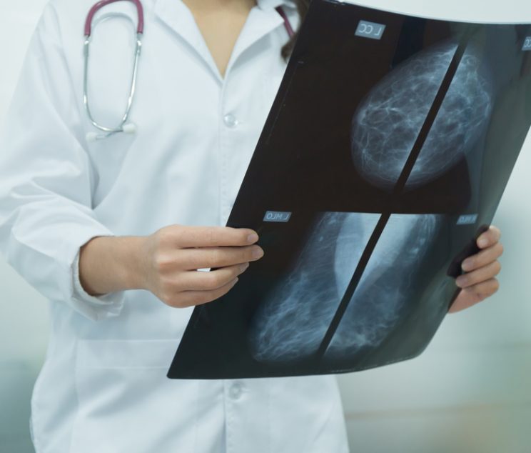 Radiology Appointments for Mammograms and MRIs Near Cumberland, MD: Prioritize Your Health Today