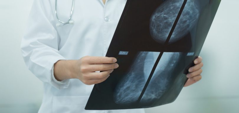 Radiology Appointments for Mammograms and MRIs Near Cumberland, MD: Prioritize Your Health Today