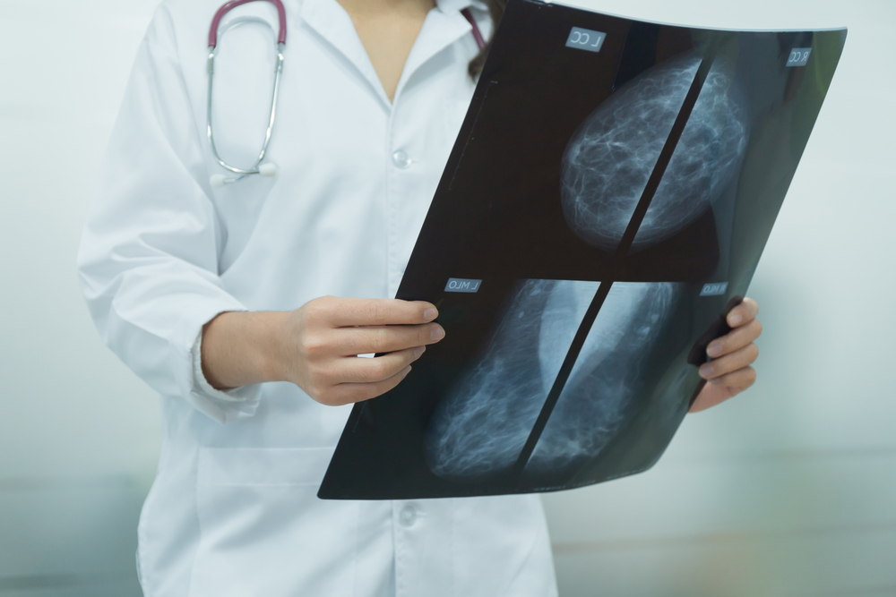 Radiology Appointments for Mammograms and MRIs Near Cumberland, MD: Prioritize Your Health Today