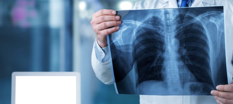 Same-Day X-Ray and Imaging Appointment Near Winchester, VA: Uses, Safety, and More