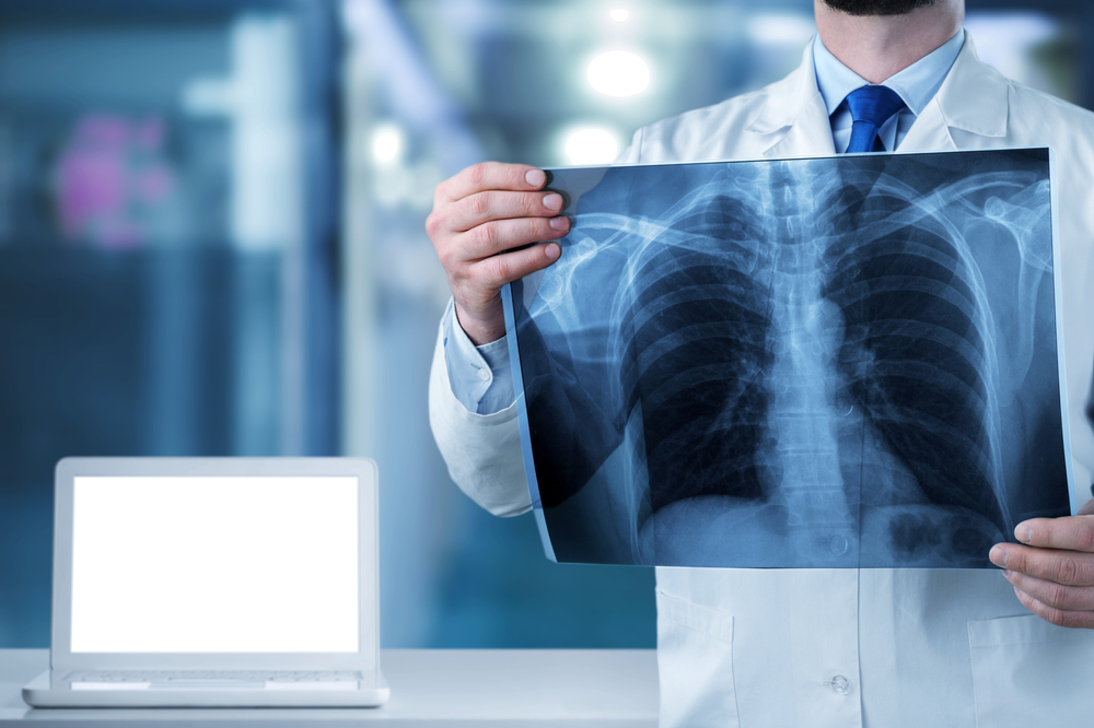 Same-Day X-Ray and Imaging Appointment Near Winchester, VA: Uses, Safety, and More
