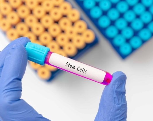 Stem Cell Doctor Near La Vale, Maryland for Chronic Joint and Spine Pain: Costs, Risks, and Results