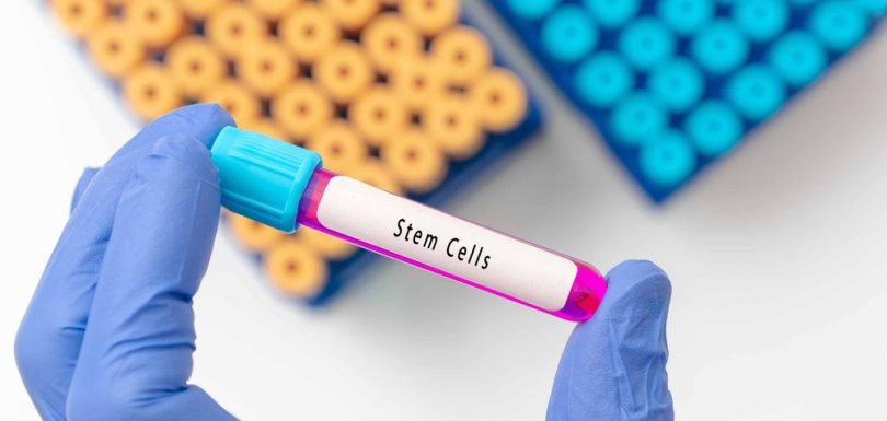 Stem Cell Doctor Near La Vale, Maryland for Chronic Joint and Spine Pain: Costs, Risks, and Results