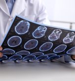 Brain MRI Imaging Near Cumberland, Maryland: What Patients Should Know